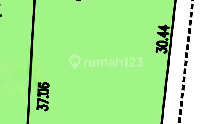 9.54M Foresta Plot Body 569M2 with 3 Views